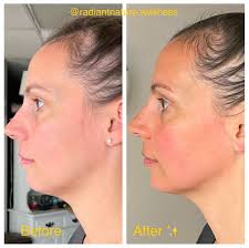 Meredith Carmen, LMT, MLD-C (@radiantnature.wellness) • Instagram photos  and videos