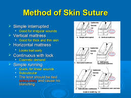 Sutures Materials