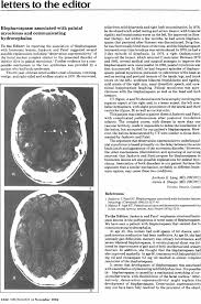 Image result for Methysergide