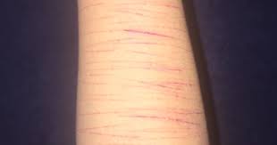 Sevdigim Cocuk Beni Sevmiyor Diye Koluma Jilet Attim Kizlarsoruyor