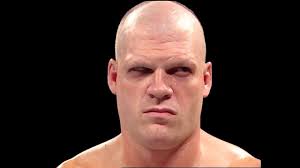 Kane should have had some long title reigns, especially around 2001 , what  do you think?