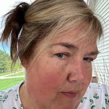 Which chicken breeds have fewer health problems?