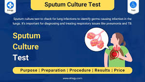 Image result for Sputum