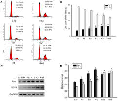 Knockdown Of Ran Gtpase Expression Inhibits The