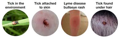 Image result for infected tick bite