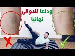 دوالي الساقين من المشاكل الصحية المرتبطة بشكل أساسي بالأمراض المهنية. ØªÙ…Ø§Ø±ÙŠÙ† Ø³Ù‡Ù„Ø© Ùˆ ÙØ¹Ø§Ù„Ø© Ù„Ù„ØªØ®Ù„Øµ Ù…Ù† Ø§Ù„Ø¯ÙˆØ§Ù„ÙŠ ØªÙ…Ø§Ø±ÙŠÙ† Ù„Ø¹Ù„Ø§Ø¬ Ø¯ÙˆØ§Ù„ÙŠ Ø§Ù„Ø³Ø§Ù‚ÙŠÙ† Youtube Beauty Skin Care Routine Workout Programs Health And Fitness Tips