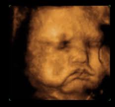 so this is my first pregnancy, but i feel like my baby is bigger then uh,  usual 😩🩷🤣 she's 33 weeks, but she looks so chubby, are all of them this  chubby