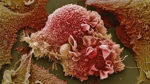 Getting tough on tuft cell lung cancer - Cold Spring Harbor Laboratory