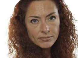 SD-politiker stäms efter hundattack