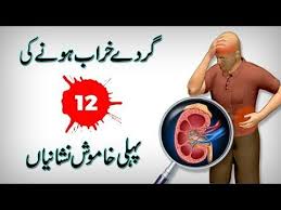 Kidney Failure Symptoms Kidney Disease Symptoms In Urdu Hindi Youtube Kidney Failure Symptoms Kidney Disease Symptoms Kidney Failure