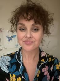 Nobody looks good after surgery. Tell that to Cher!