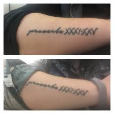 Easy tattoo that lasts up to 2 months! Fade Fast Tattoo Removal 21 Reviews Tattoo Removal 2928 Main St Deep Ellum Dallas Tx United States Phone Number Yelp