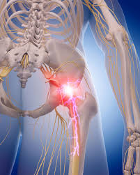The muscles of the abdomen, lower back, and pelvis are separated from those of the chest by the muscular wall of the diaphragm, the critical breathing muscle. Sciatica And Sciatic Nerve Pain Information