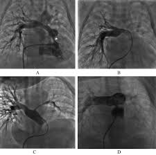 2021 Review: Transcranial Doppler Ultrasound Imaging | Imaging Technology  News