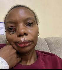 HelpTrezaFightCancer