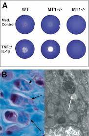 Tubidy mobile search / tubidy download 2021 free m. Mt1 Mmp A Tethered Collagenase Holmbeck 2004 Journal Of Cellular Physiology Wiley Online Library