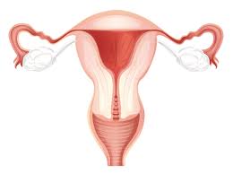 Ovarian Remnant Syndrome The Center For Endometriosis Care