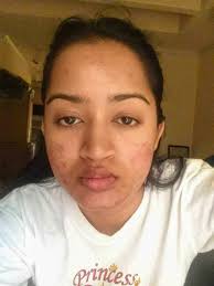 I couldn't hide the huge bumps