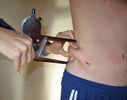 Stretching one's ear is a fairly common body modification in today's society. Skinfold Measures Of Body Fat