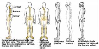 It is one of the important questions for those people who are suffering from poor body posture. Cervical Posture Stabilization Life S Work Physical Therapy