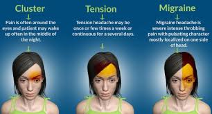 How To Get Rid Of A Headache Fast Medi Connect India