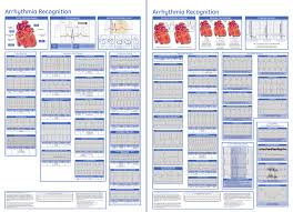 arrhythmia ecg examples poster related keywords