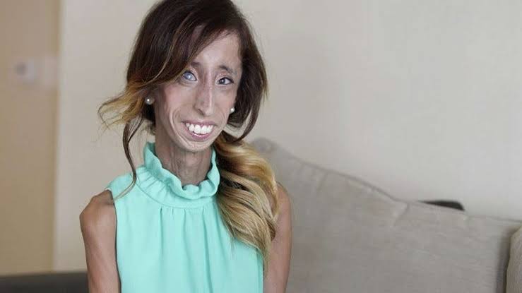 Lizzie Velasquez chooses happiness, fights bullying