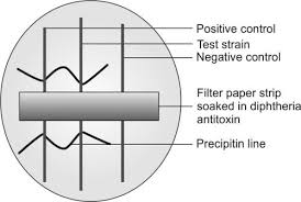 Ag is streptolysin o =so (immunogenic). Jaypeedigital Ebook Reader