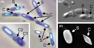Image result for Cyperus breviradius