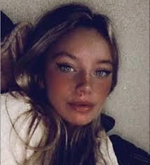 Mum fined £500 after XL Bully dog mauled seven-year-old girl