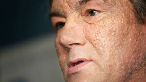 26 presidential election, is believed to have been poisoned with dioxins. Six Other Prominent World Figures Maimed Or Killed In Poison Attacks