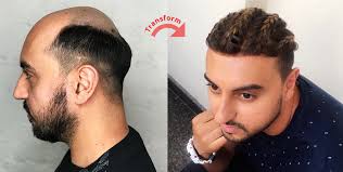 Haircut places & hair salons near me. Best Hair Replacement Systems From Natural Hair Made In Canada