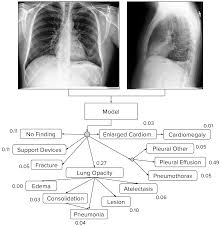 The hepatic flexure and the. Chexpert A Large Chest Radiograph Dataset With Uncertainty Labels And Expert Comparison