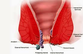 Image result for itchy skin rectum