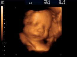 Baby Boy At 29 Weeks Ultrasound Pictures 3d Ultrasound 3d Ultrasound Pictures