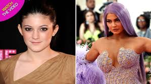 Kylie jenner just shared a bunch of old photos of herself and stassie karanikolaou to celebrate stassie's birthday. Inside Kylie Jenner S 30k Body Overhaul As Surgeon Explains Transformation Mirror Online