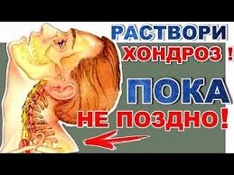 как снять боль при шейном остеохондрозе в домашних условиях Kak Izlechit Shejnyj Osteohondroz Navsegda Top Recept Dlya Shei Youtube Zdorove Fizkulturnye Uprazhneniya Uprazhneniya