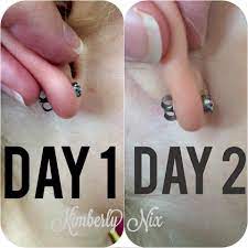 How To Heal An Infected Pierced Ear Naturally Ear Piercing Care Infected Ear Piercing Ear Piercings Tragus