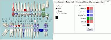 open dental software draw on tooth chart