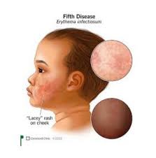 Wallace H. Braden Middle School