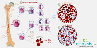 Some signs or symptoms are similar to other more common and less severe illnesses. Hairy Cell Leukemia Causes Symptoms And Treatment