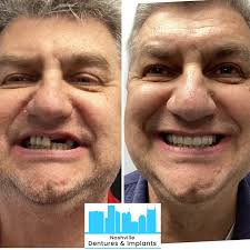Nashville Dentures & Implants‎
