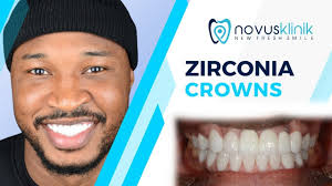 Adam’s 4-Day Journey to a Perfect Smile: Dental Veneers in Turkey by  Novusklinik Istanbul