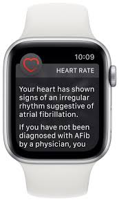 Apple Ekg Watchos 5 2 Now In Eu Ekg Ecg App Apple