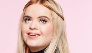Many of these associated conditions can be treated with medication, surgery, or other interventions. Irish Model With Down Syndrome Kate Grant Gets Job With Benefit Brand