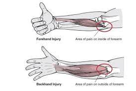 Pin On Anatomy