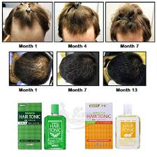 113136 yanagiya hair tonic yanagiya тоник против выпадения волос нет в наличии. Yanagiya Hair Tonic Citrus 240ml Shopee Malaysia