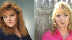 Robbery victim: “My face was shot off