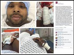 Porn Star Rico Strong Suffers Horrific Injury Due To Caverject (Graphic  Photos) | STR8UPGAYPORN