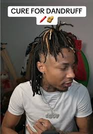 Effective Dandruff Treatment for Curly Hair and Dreads